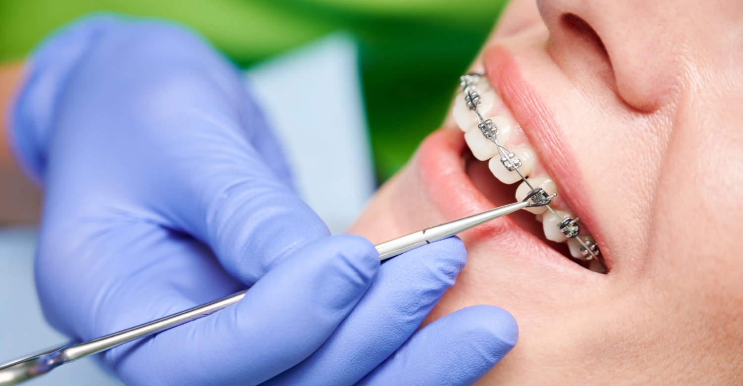 What is adult orthodontics